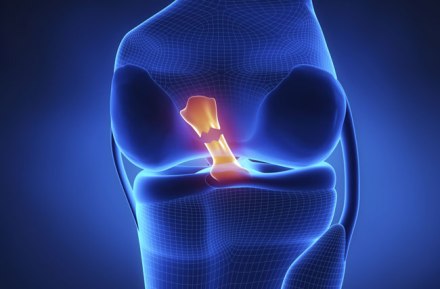 anterior_cruciate_ligament_1
